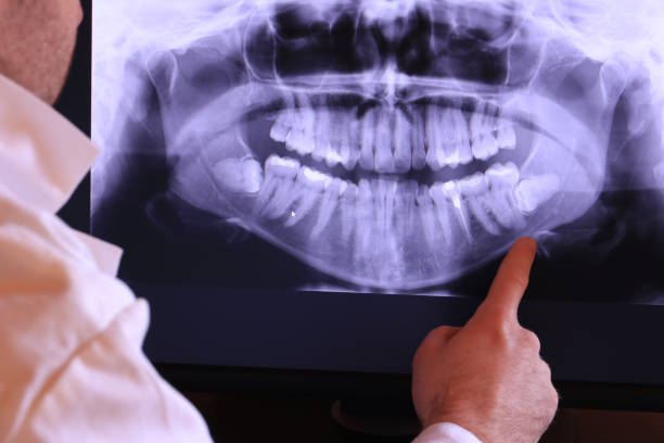 Best Emergency Tooth Extraction  in Maple Park, IL