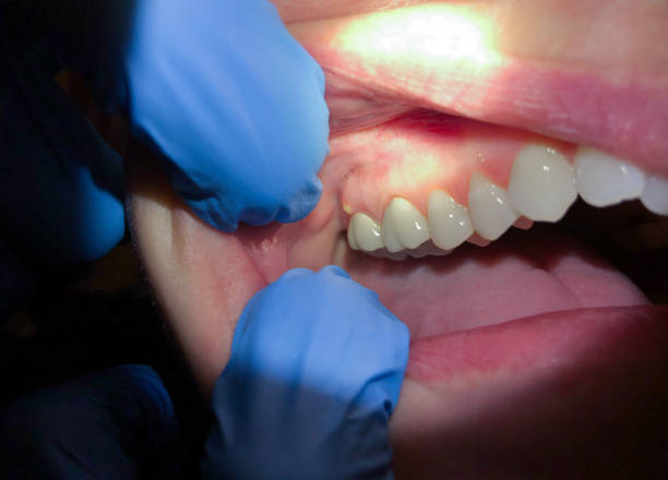 Best Broken Tooth Emergency  in Maple Park, IL